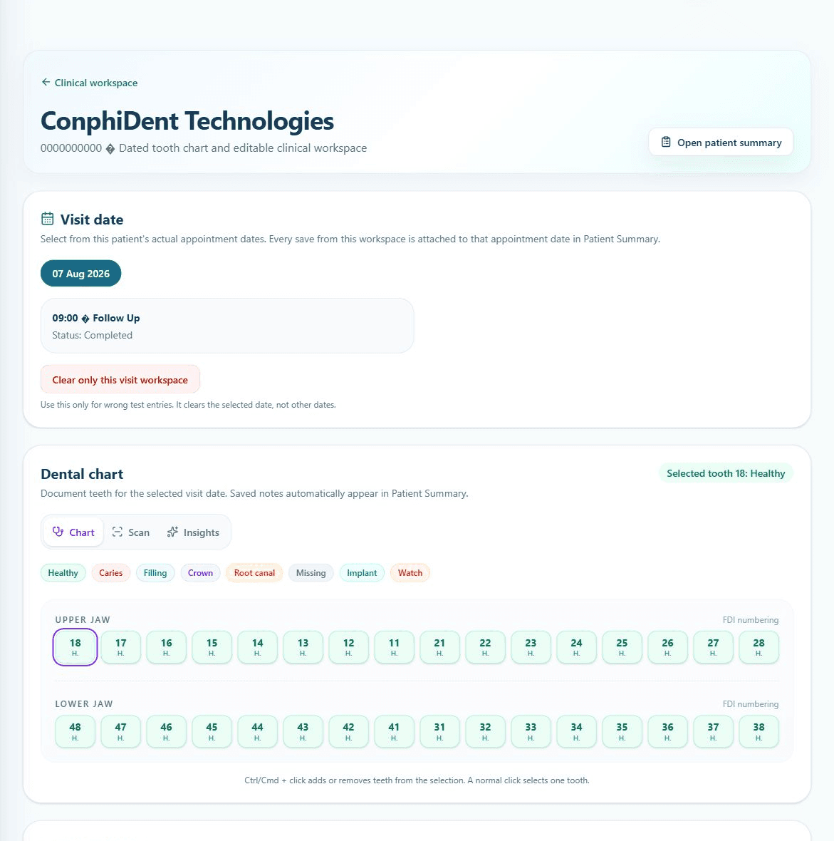 ConphiDent clinical workspace and dental chart using fictional demo data